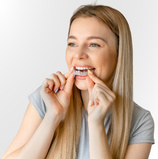 Clear Aligner